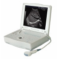 Scanner à ultrasons professionnel pour ordinateur portable médical (THR-LT001)